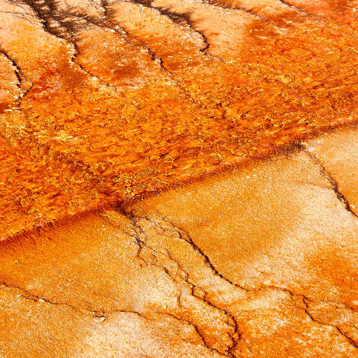 Hyperpigmentation